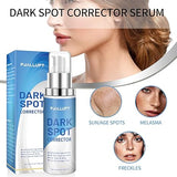 Dark Spot Remover for Face & Body, Dark Spot Corrector Serum for Age Spots, Sun Spots, Freckles, Brown Spot, and more, 1.0 Fl.OZ