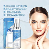 Dark Spot Remover for Face & Body, Dark Spot Corrector Serum for Age Spots, Sun Spots, Freckles, Brown Spot, and more, 1.0 Fl.OZ