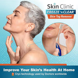 Skin Clinic FREEZE 'n CLEAR Skintag Remover - Cryogenic Kit (8 - Applicators + Tweezers), Freezing Tag Treatment Solution for Adults